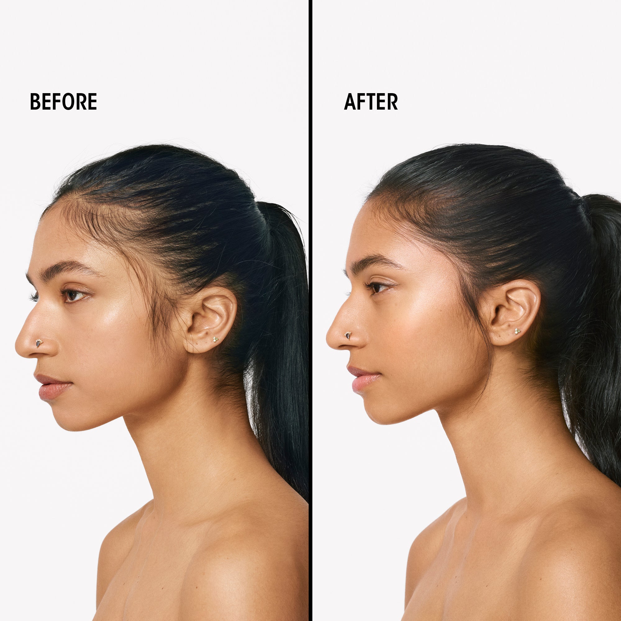 Serene Scalp Densifying Treatment Spray - Image 3